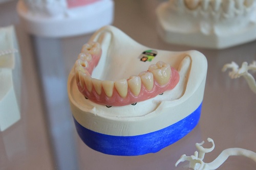 Citerm | Zubna tehnika